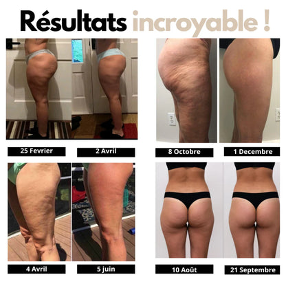 Ces Leggings 3D Réduisent Visiblement la Cellulite en 14 Jours — ou Vous Êtes Remboursée